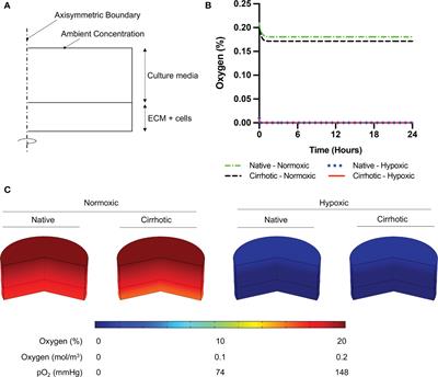 Tumor Microenvironment Alters Chemoresistance of Hepatocellular Carcinoma Through CYP3A4 Metabolic Activity